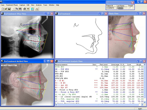 computerized orthodontic image